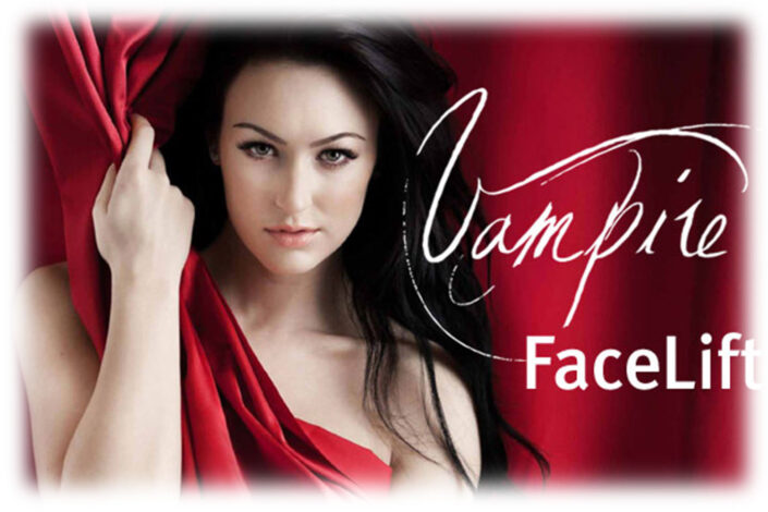 Vampire Face Lift Service - Isabella Mia Skincare