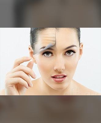Botox-Injection-Isabella-Mia-Skincare