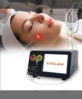 Endolift-Isabella-Mia-Skincare