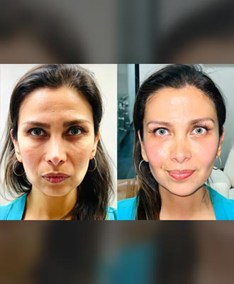 Isabella-Mia-Glowing-Facelift-Isabella-Mia-Skincare