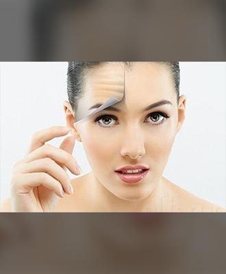 Botox-Injection-Isabella-Mia-Skincare