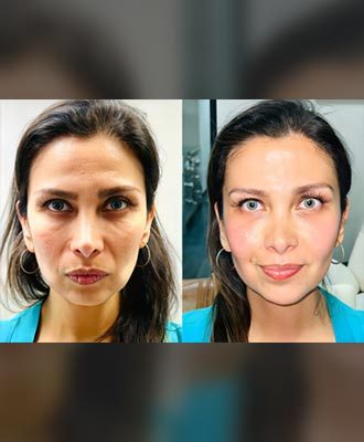 Isabella-Mia-Glowing-Facelift-Isabella-Mia-Skincare